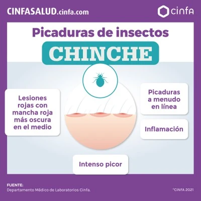 Consejos para eliminar picaduras de insectos en muebles